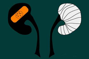 腎病為什么會發(fā)展到尿毒癥？這些因素一定要注意