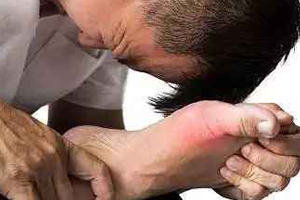 痛風(fēng)可以治愈嗎？無法治愈但能控制