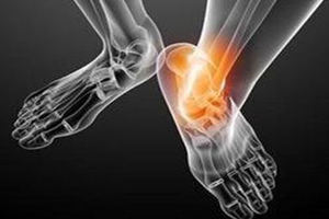 痛風(fēng)跟飲食有關(guān)？痛風(fēng)更多與遺傳有關(guān)