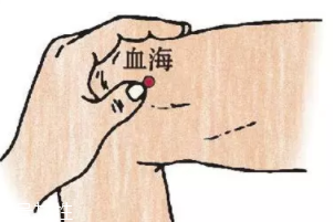 濕疹怎么治才管用？內(nèi)外同治是關(guān)鍵