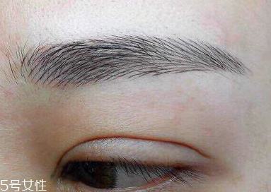 激光洗眉恢復期有疤痕怎么辦？激光洗眉毛之后正確護理方法