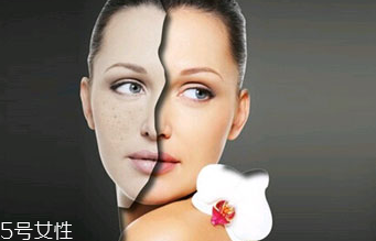 點(diǎn)痣的危害有哪些？激光點(diǎn)痣后的飲食禁忌