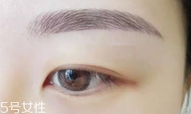 激光洗眉恢復期有疤痕怎么辦？激光洗眉毛之后正確護理方法