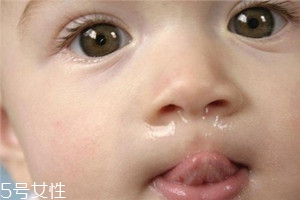 冬季寶寶流鼻涕是什么原因？教你幾招輕松應對