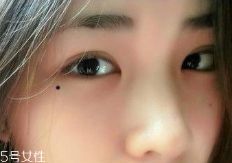 痣越多越長壽嗎？身上最有福氣的吉痣