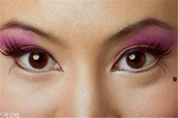 黑痣是怎么形成的？防范黑色毒瘤