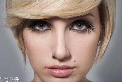 黑痣是怎么形成的？防范黑色毒瘤