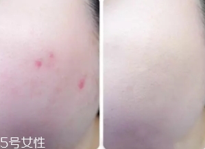 cpb遮瑕棒怎么樣？來看看使用效果