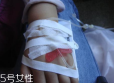 輸液治療不適合哪些?。窟^(guò)敏反應(yīng)危害大