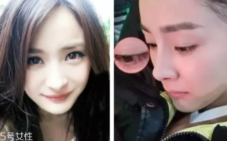 內(nèi)雙怎么進(jìn)化成雙眼皮？全是雙眼皮貼的功勞