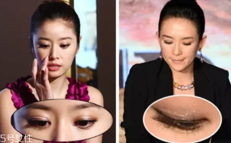 內(nèi)雙怎么進(jìn)化成雙眼皮？全是雙眼皮貼的功勞