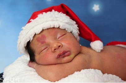 胎記長(zhǎng)在哪里有福氣？胎記的本質(zhì)是色素沉著