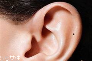 臉上哪些痣不能去掉？這些痣不能隨便祛掉