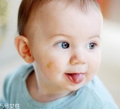 胎記怎么去除？胎記有遺傳的可能