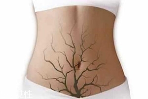 體內(nèi)毒素超標(biāo)有何表現(xiàn)？五大癥狀須注意