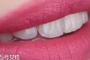 kiko哪個(gè)顏色適合黃皮？kiko口紅9系最便宜