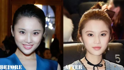 瑯琊榜2張慧雯整容了嗎？換了妝發(fā)美到不認(rèn)識(shí)