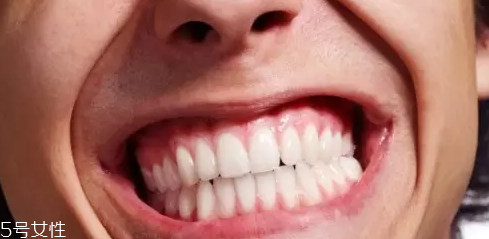 磨牙是因?yàn)槭芰宋?？孩子的心理狀況也會(huì)導(dǎo)致磨牙