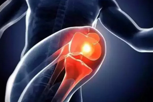 關(guān)節(jié)有響聲是病嗎？兩種情況區(qū)別對待