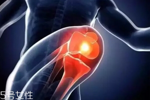 關節(jié)有響聲是病嗎？兩種情況區(qū)別對待