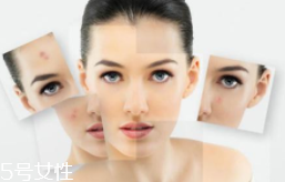 光敏食物真的會(huì)導(dǎo)致變黑嗎？只有敏感皮才要注意