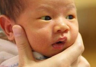 新生兒長黃疸怎么辦？有些黃疸癥狀媽媽們可別忽視