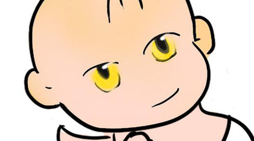 新生兒長黃疸怎么辦？有些黃疸癥狀媽媽們可別忽視