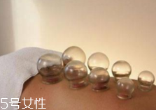 拔火罐引火上身的原因是什么？這4點(diǎn)要注意