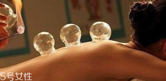 拔火罐引火上身的原因是什么？這4點(diǎn)要注意