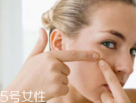 肌膚需要排毒嗎？長痘并不代表排毒