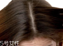 油性頭發(fā)跟什么有關(guān)？離不了這6個(gè)原因