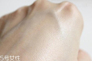 白癜風(fēng)與身體免疫功能有關(guān)系嗎？兩者關(guān)系密切