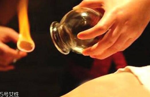 拔罐后身上后背持續(xù)發(fā)癢怎么回事？體內(nèi)風(fēng)邪是主因