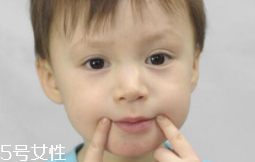 冬天爛嘴角什么原因？有可能營養(yǎng)不良