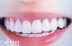 牙線和漱口水是否必要？抑菌護(hù)牙好習(xí)慣