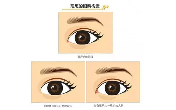 開外眼角和開內(nèi)眼角哪個好？開眼角有可能會回縮