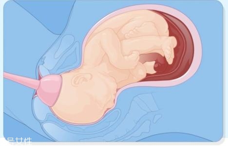 怎樣判斷自己能不能順產(chǎn) 判斷的3個(gè)依據(jù) 怎樣判斷自己能不能順產(chǎn) 判斷的3個(gè)依據(jù)