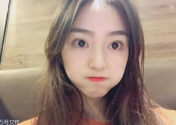 割雙眼皮要注意什么？割雙眼皮充血是正常現(xiàn)象