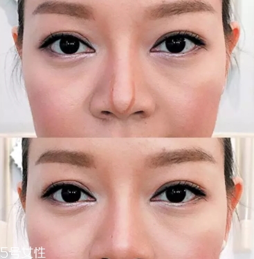 眉粉可以當鼻影用嗎？眉粉這樣畫鼻影