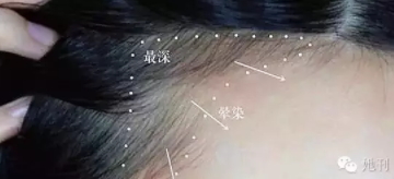 眉粉可以當(dāng)發(fā)際線粉嗎？解救高發(fā)際線的技巧