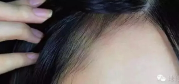 眉粉可以當(dāng)發(fā)際線粉嗎？解救高發(fā)際線的技巧