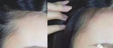 眉粉可以當(dāng)發(fā)際線粉嗎？解救高發(fā)際線的技巧