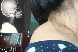 富貴包是什么??？姿態(tài)優(yōu)美少犯病