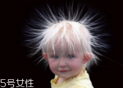 少年白什么原因？焦慮緊張會得病