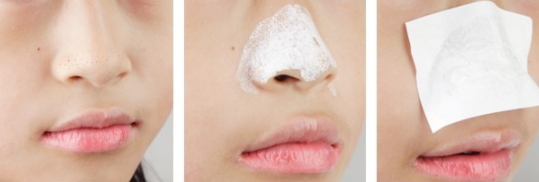 鼻貼的使用方法 撕拉式涂抹式三部曲式鼻貼用法不同 鼻貼的使用方法 撕拉式涂抹式三部曲式鼻貼用法不同