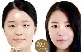 蕾絲雙眼皮貼好用嗎？蕾絲雙眼皮貼教程