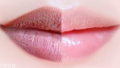 唇膏可以祛痘嗎？小心致痘風(fēng)險