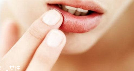 蘭芝唇膜孕婦能用嗎？起皮嘴唇的福音