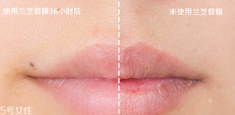 蘭芝唇膜小孩能用嗎？蘭芝唇膜正確使用方法