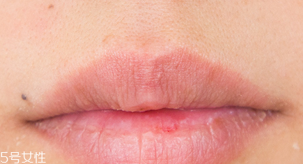 蘭芝唇膜小孩能用嗎？蘭芝唇膜正確使用方法